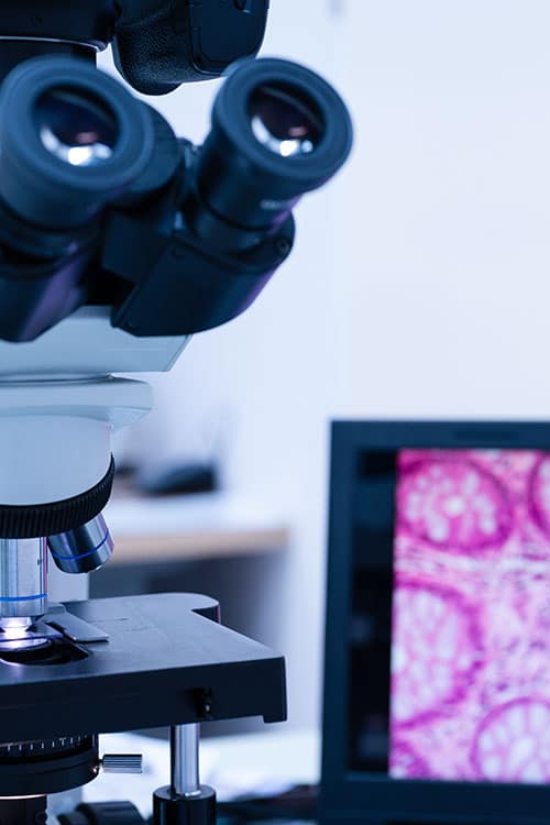 Close-up of a microscope in a veterinary laboratory. In the background, a computer screen displays an out-of-focus image of pink and purple patterns, likely a magnified tissue sample analyzed by the veterinarian.